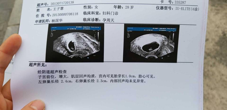 孕妇14周是几个月，孕期时间换算与孕期保健指南